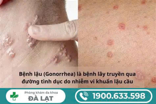 Hình ảnh minh họa